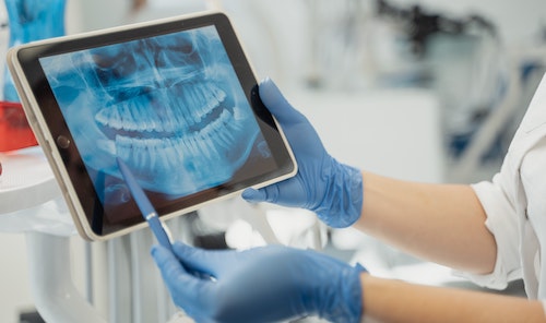 hampton park dentist evaluating scan for wisdom tooth removal