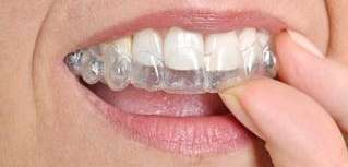 woman putting on her Invisalign clear braces in hampton park vic
